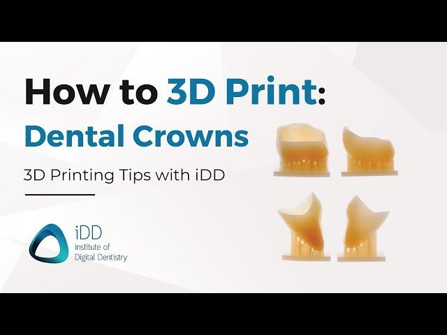 Step-By-Step Guide: How to 3D Print Dental Crowns using SprintRay Pro 55S | iDD