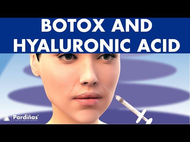 Botox or hyaluronic acid? - TREATMENT FOR WRINKLES on the face ©