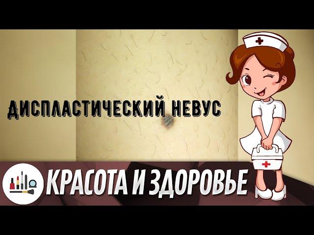 Диспластический невус