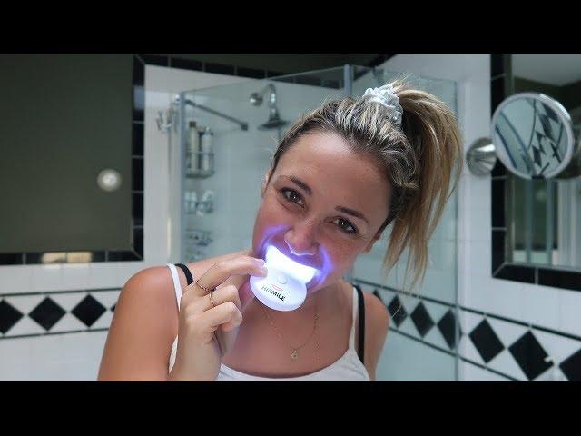 Do at-home teeth whitening kits really work? | Glam Lab