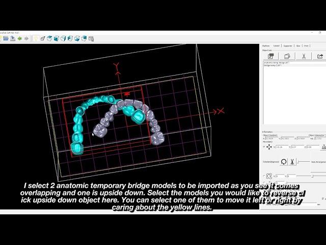 DentaFab Nesting and Support for Temporary Design