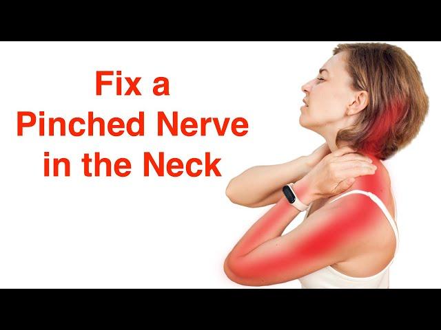 Fix a Pinched Nerve in the Neck (With FREE Exercise Sheet!)