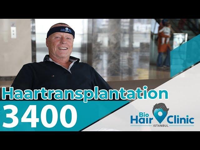 Wie fühlt man sich nach der Haartransplantation ? | Bio Hair Clinic Istanbul