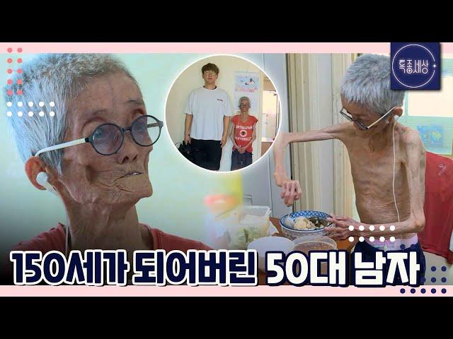 [FULL영상] "살아있는 게 기적.." 남들보다 세 배 빨리 늙는 남자의 사연은?｜MBN 180831 방송