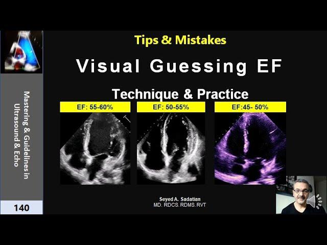 Visual Guessing Ejection Fraction- Technique & practice