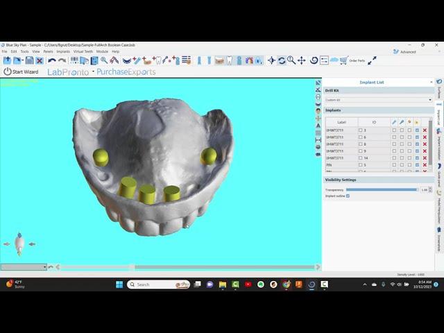 BSPGuide: Making a Prosthetic chairside Convertible using "Create Surface"