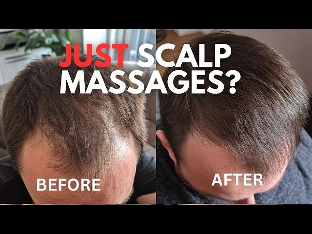 Regrow Your Hair with Scalp Massages (How to guide)