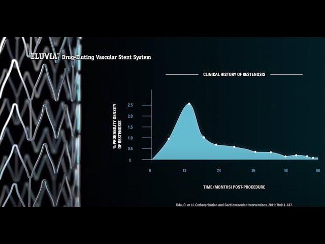 Eluvia™ Drug-Eluting Vascular Stent: The Solution