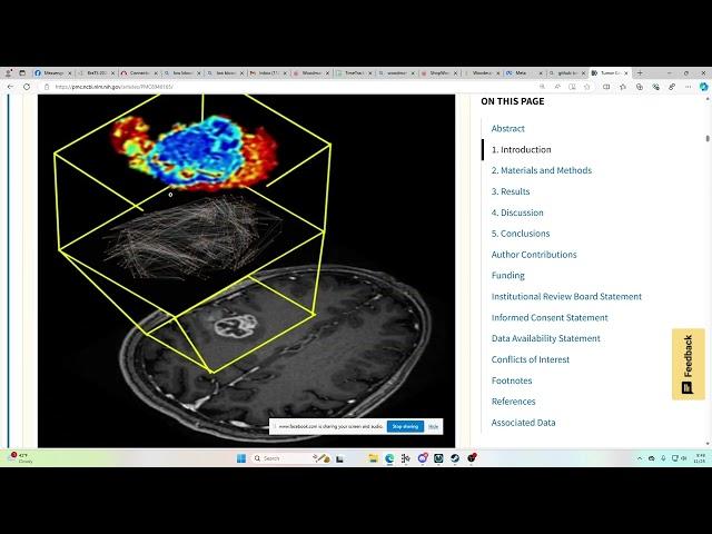 NeuroCavePlus immersive visual exploration BraTS mpMRI data with Tumor Connectome Framework analysis