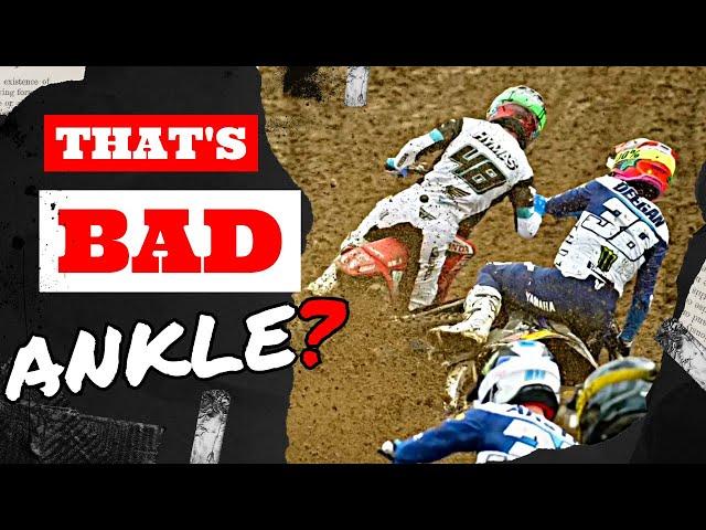 MXunfiltered E 32 Hymas Ankle Sexton Champion