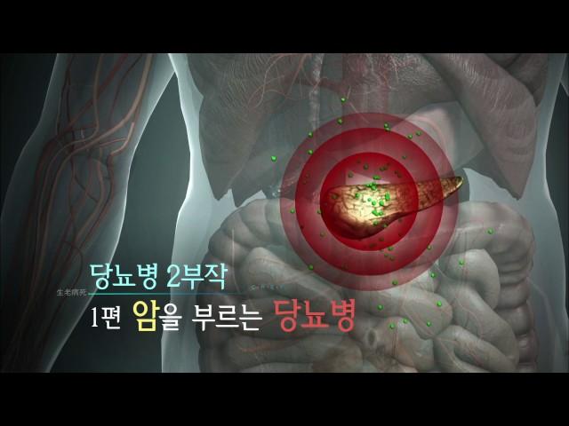 생로병사의 비밀 - 암을 부르는 당뇨병 1.20170614