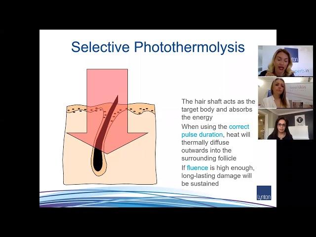 Lynton Lasers Free Webinar  Introduction to Hair Removal with LASER & IPL