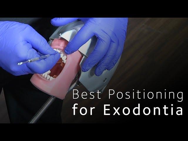 Best Positioning for Minimally Invasive Exodontia