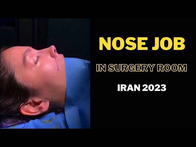 Nosejob Result by Dr. Nouri in the Operating Room