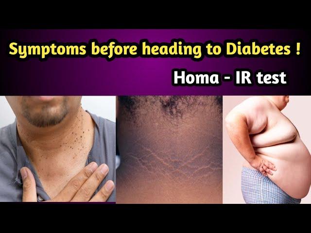 Symptoms before heading to Diabetes - Homa IR test