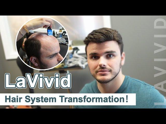 Hair System Transformation| LaVivid Hair System