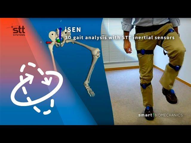 3D gait analysis with STT inertial sensors