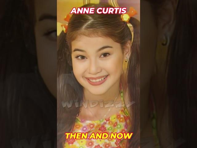 ANNE CURTIS - Then And Now