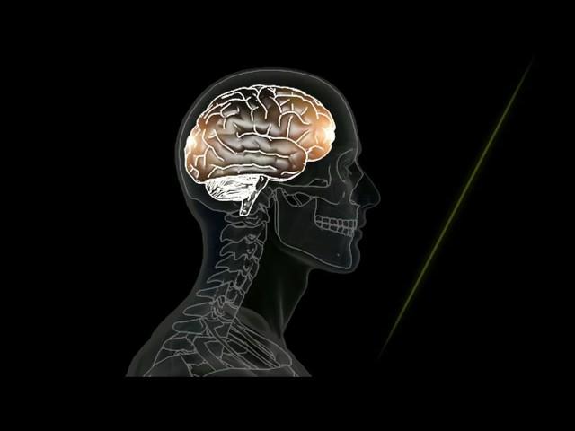 What Is A Concussion