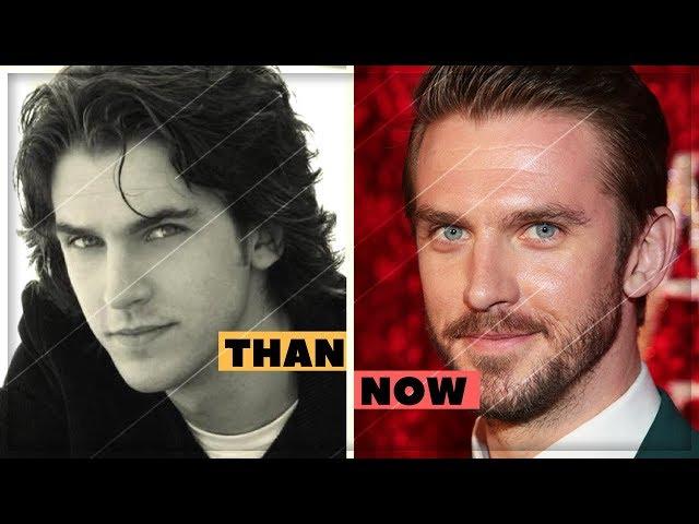 Dan Stevens Amazing Changing Looks | Dan Stevens Transformation