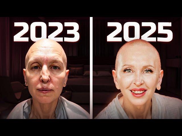 Помолодела на 15 Лет за 2 Года / Что Я Делала / Честный Разговор