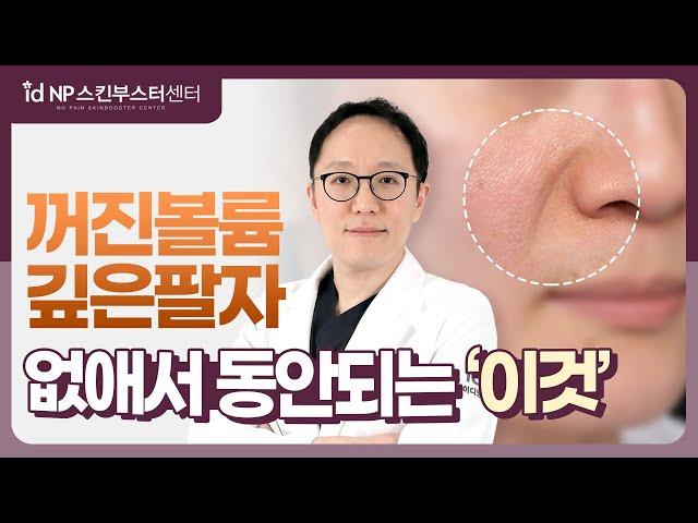 팔자주름시술은? 콜라겐부스터 쥬베룩, 울트라콜200로 자연스럽게