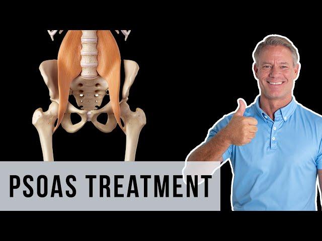 Fix Your Popping or Clicking Hip with a Detorsion of the Psoas Fascia