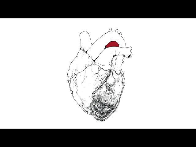 Swans - Michael is Done