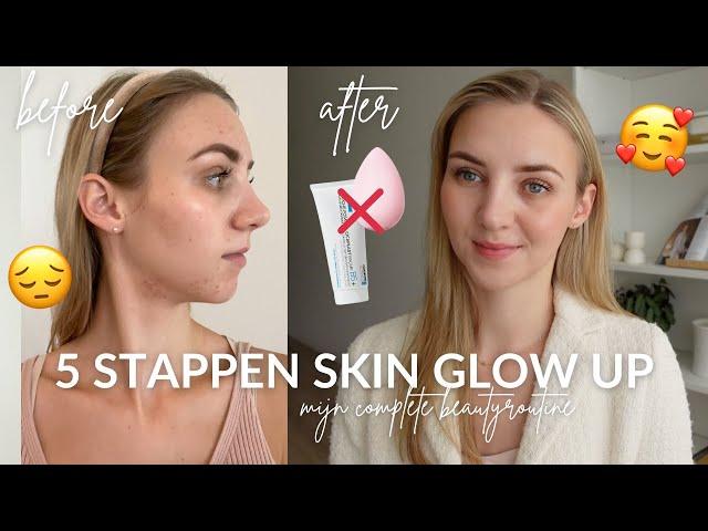 Zo werd mijn huid EINDELIJK egaal | Nieuwe tips | Beauty routine zonder foundation | Julia Verbij