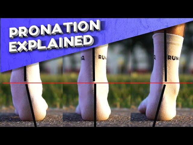 What is overpronation? | Pronation types explained