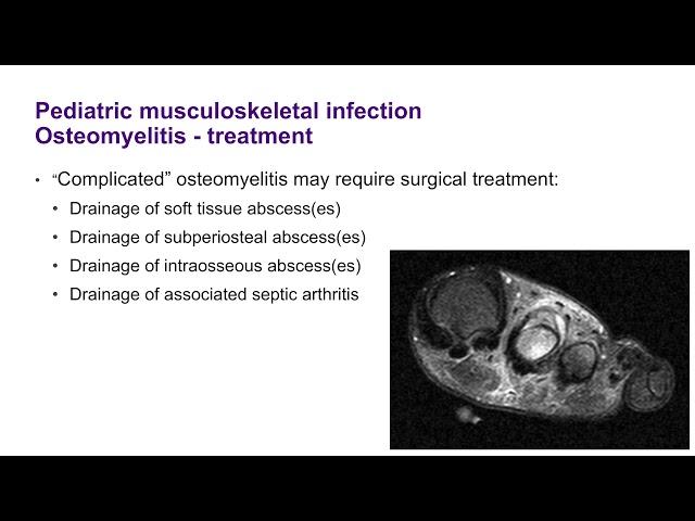 Musculoskeletal Infection in the Pediatric Patient - ABOS Orthopedic Surgery Board Exam Review