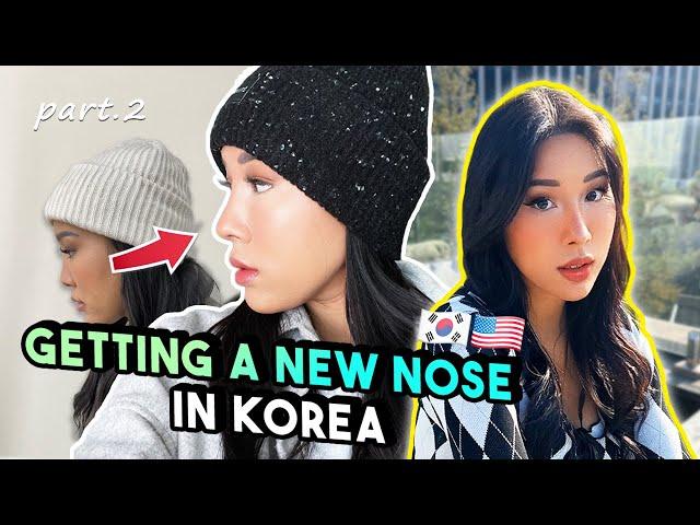 NOSE JOB REVEAL.... | plastic surgery in korea