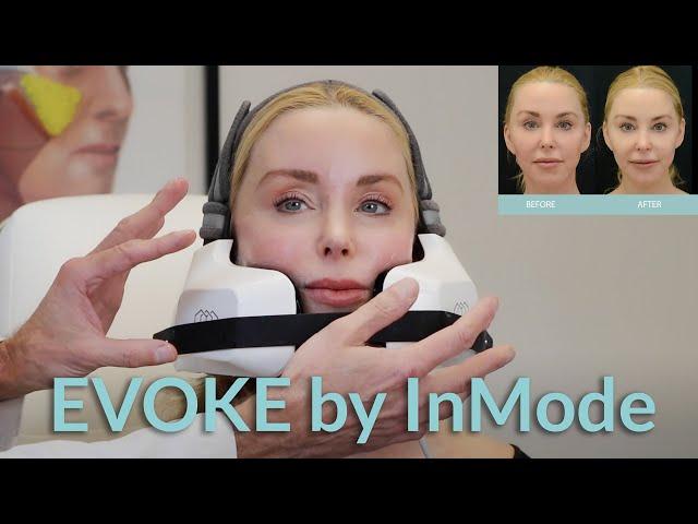 EVOKE by InMode: Saggy Skin Treatment Over 50