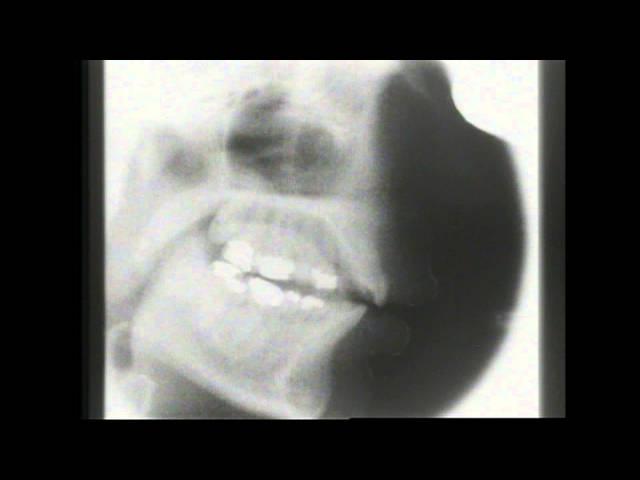 Kevin Munhall Xray Database 4