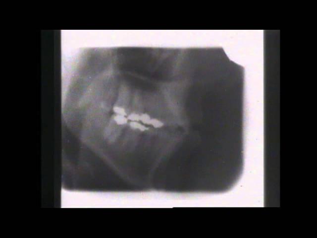Kevin Munhall Xray Database 1