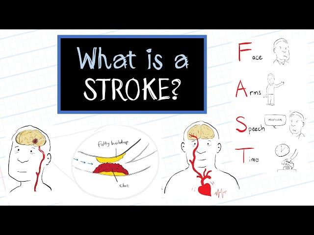 What is a Stroke? (HealthSketch)