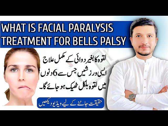 bells palsy | bells palsy treatment | bells palsy exercises | bell's palsy symptoms