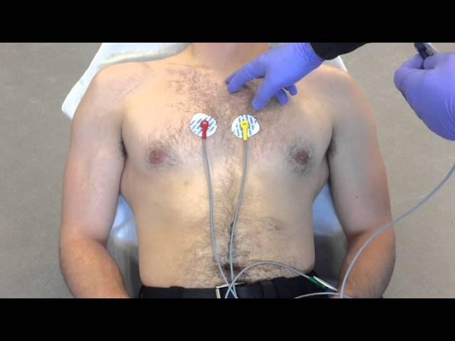 12 Lead ECG Placement example