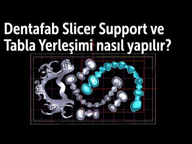 Dentafab Slicer Support ve Tabla Yerleşimi nasıl yapılır?