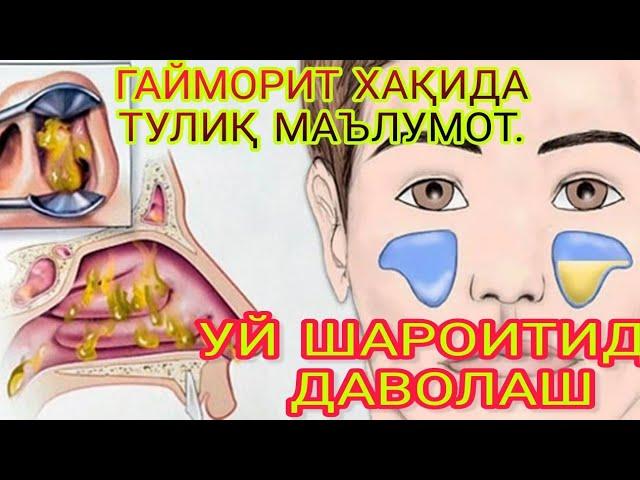 ГАЙМОРИТ БУ НИМА?  УЙ ШАРОИТИДА ДАВОЛАШ ЮЛЛАРИ. GAYMORIT BU NIMA?