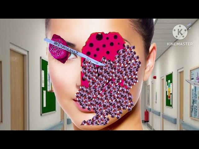 ASMR face & head treatment | ASMR removal trypophobia & maggot infected face | ASMR 2d animation |