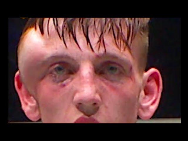 ️ SHOCKING head injury in a Muay thai fight  #shorts #mixedmartialarts #ufc #injuries #mma