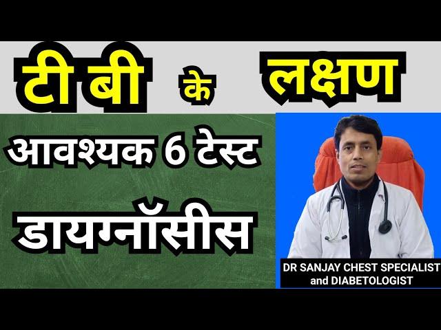 TB ke Lakshan // Symptoms of Tuberculosis // Diagnosis of Tuberculosis // #DrSanjayChestSpecialist