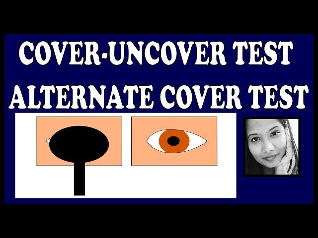 Cover Tests Explained | Squint Simplified for Medical Students