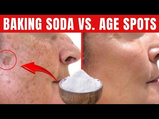 BAKING SODA permanently remove AGE SKIN SPOTS! Do this...