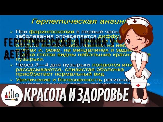 Герпетическая ангина у детей