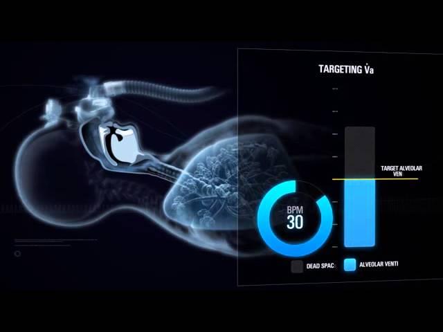 S9 VPAP ST-A with iVAPs