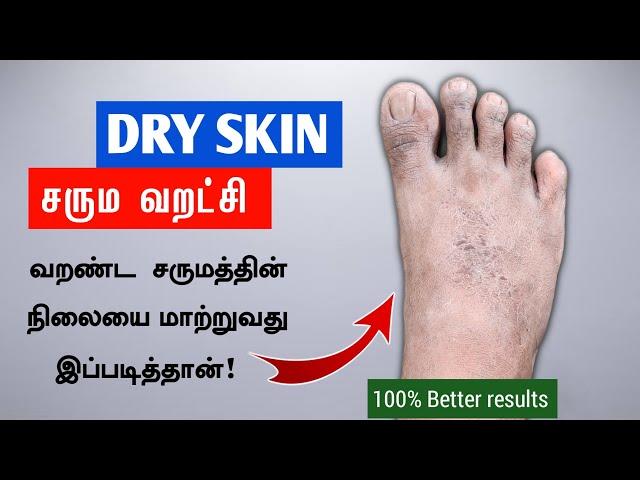 உண்மையிலேயே ஆச்சரியம் அளிக்கும் வறண்ட சரும எண்ணெய் | Dry Skin Tips | Dermatitis | Next Day 360