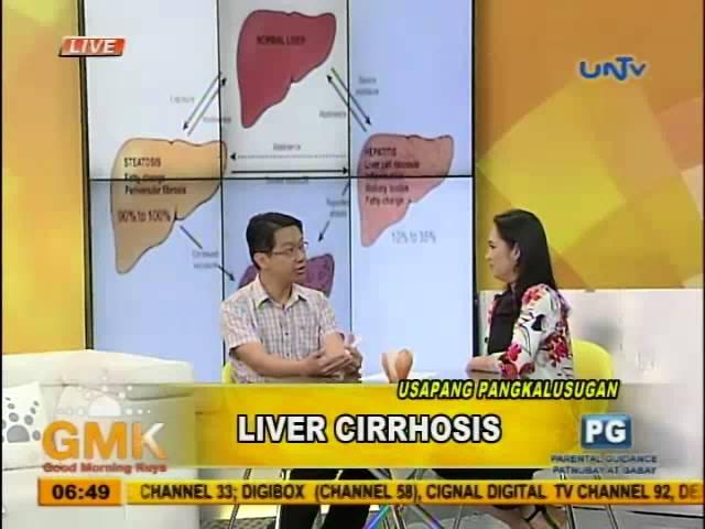 Understanding Liver Cirrhosis