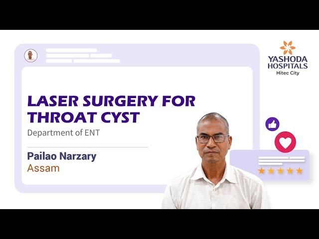 Laser Surgery for Throat Cyst | MLS and Transoral Excision of Epiglottial Cyst | Yashoda Hospitals